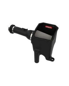 aFe Takeda Stage-2 Cold Air Intake System w/ Pro Dry S Filter 17-20 Honda Civic Si L4-1.5L (t) - 56-10027D