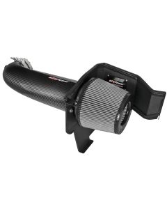 aFe POWER Magnum FORCE Carbon Fiber Stage-2 Track Series Pro DRY S Cold Air Intake System Dodge Chal